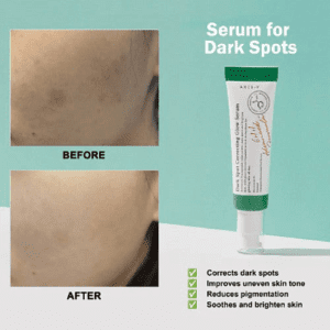 Dark Spot Correcting Glow Serum – Axis-Y